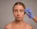 What You Should Know About Double Eyelid Surgery: A Guide for Women