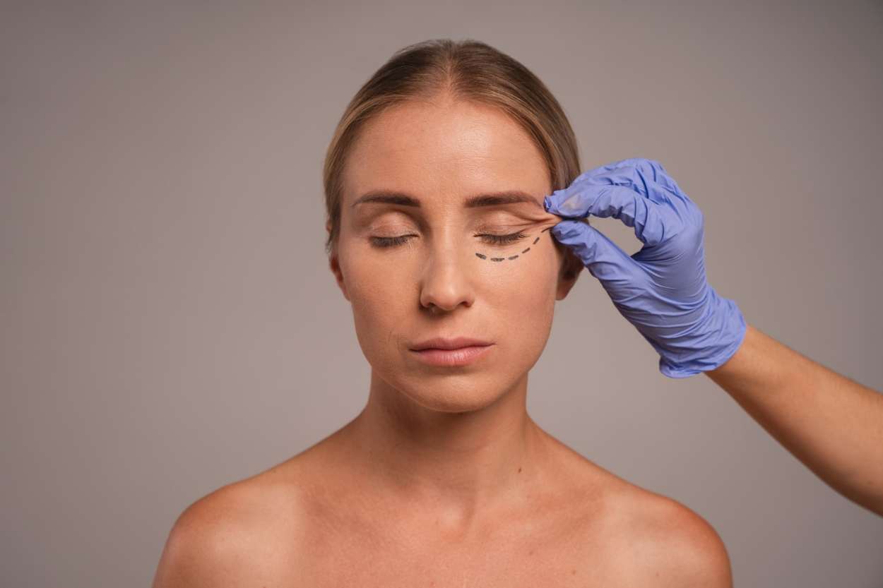 What You Should Know About Double Eyelid Surgery: A Guide for Women
